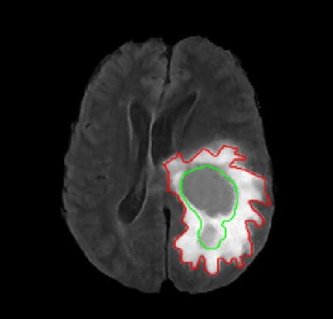 Medical imaging segmentation sample